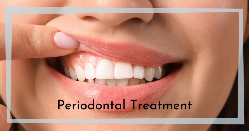 Periodontal Treatment