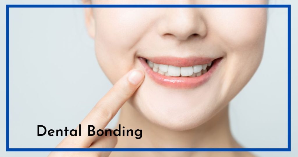 dental bonding fairfield Texas