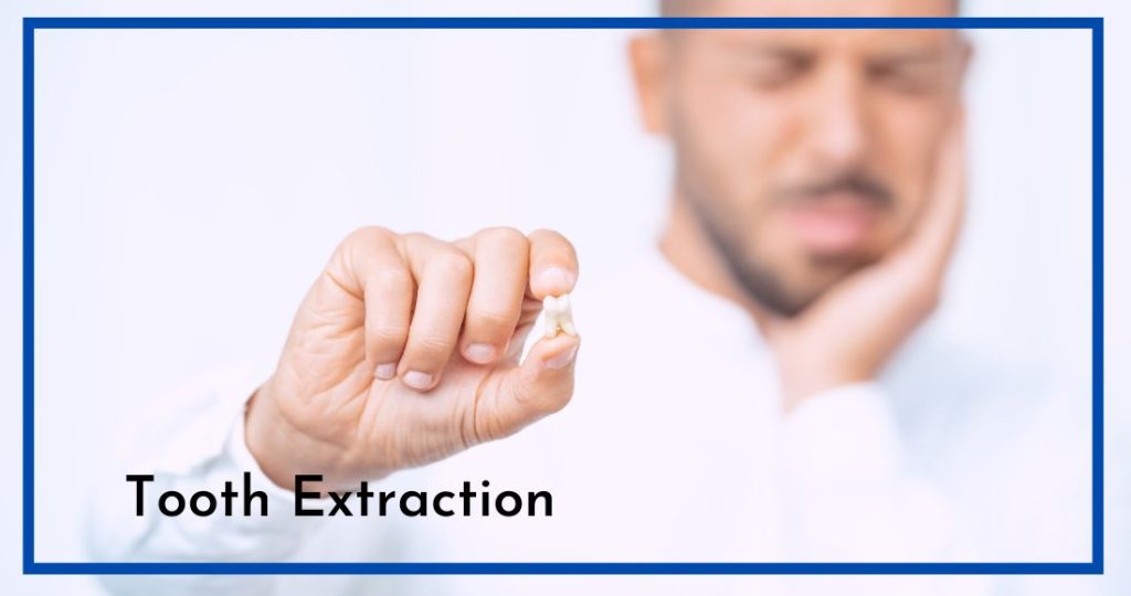 teeth extractions